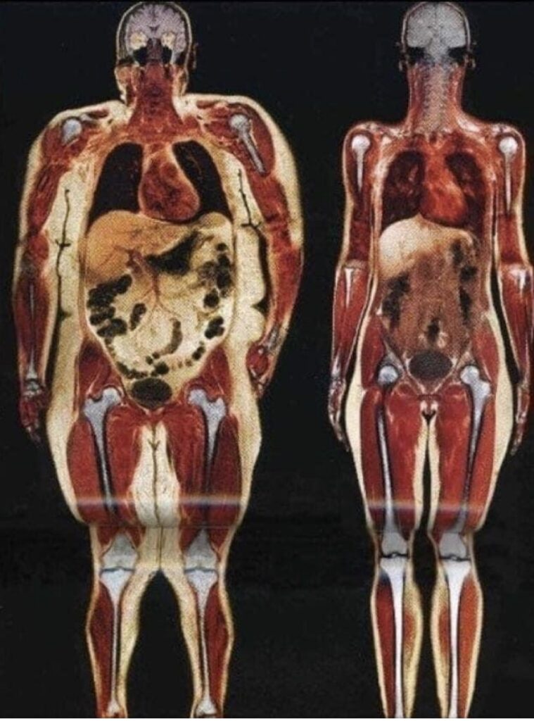 fat inside the body